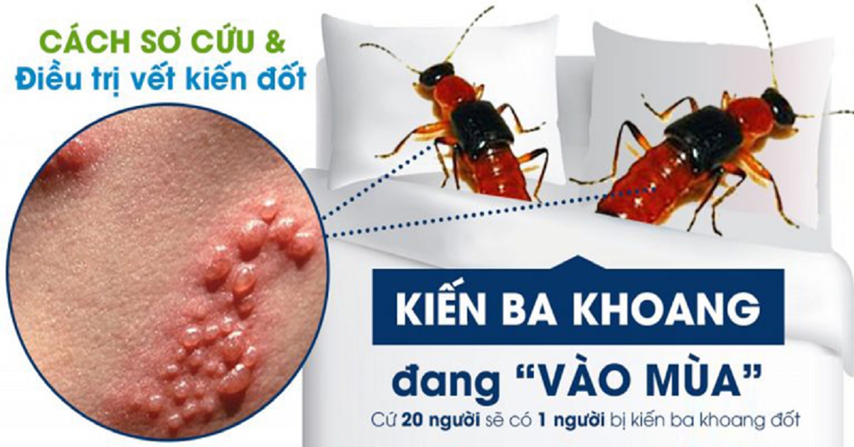 TOP 18 cách diệt kiến vĩnh viễn trong nhà