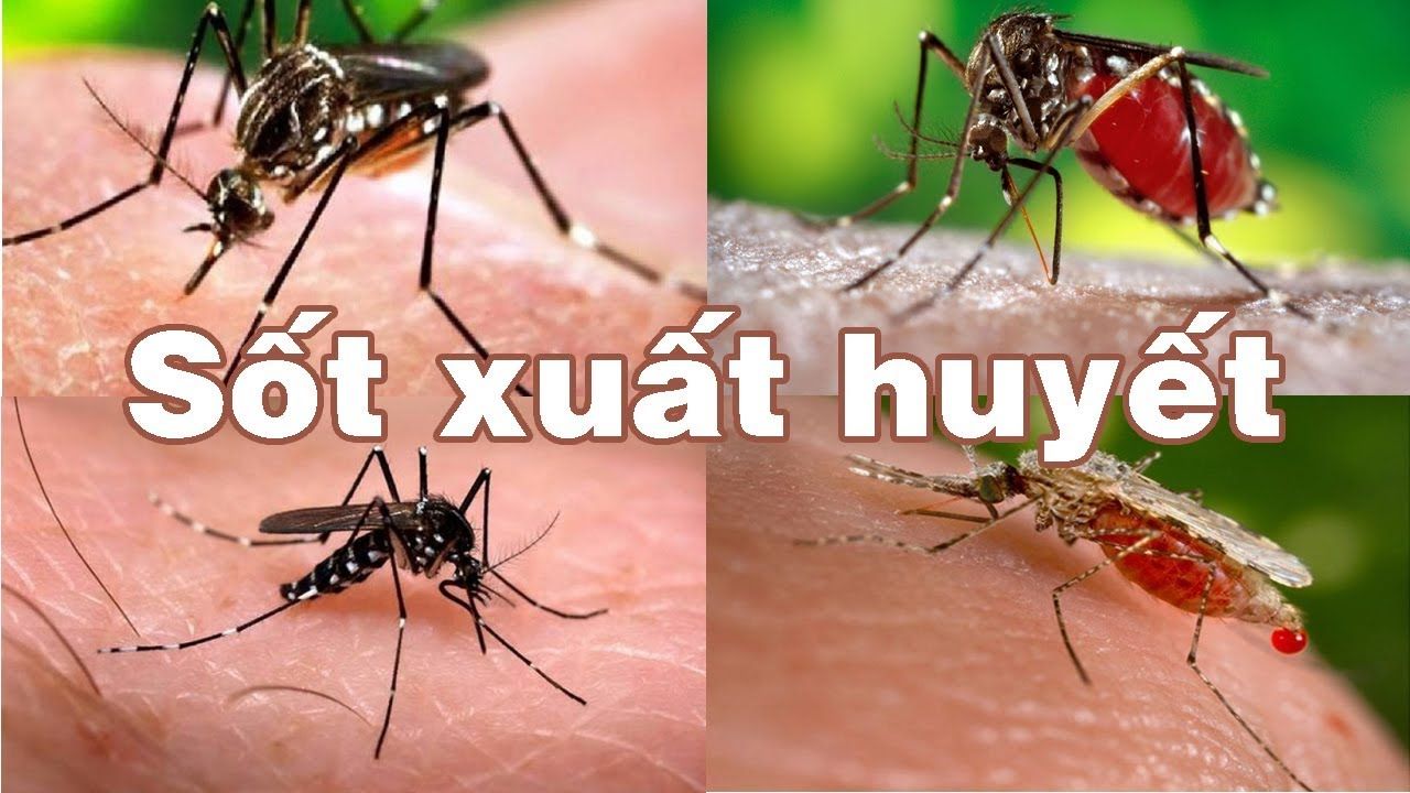 Cách phòng dịch sốt xuất huyết – Diệt trừ muỗi gây bệnh lây truyền